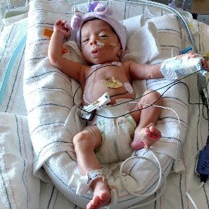 NICU close-up photo of Charlie or JoJo resting in 2017