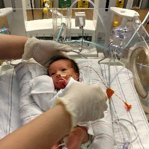 NICU close-up photo during care in the incubator in 2017